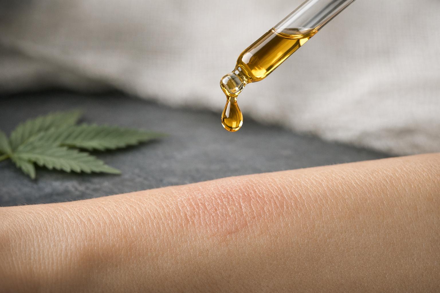 CBD et psoriasis : état des connaissances actuelles